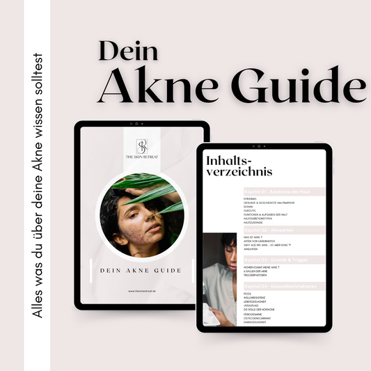 Dein Akne Guide